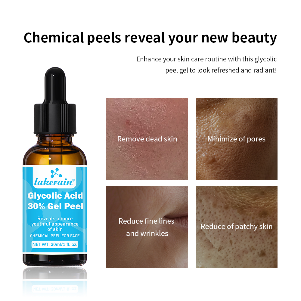 30% Gel kulit asam glikolat ku - Glycolic Acid Exfoliant ulasan dan harga