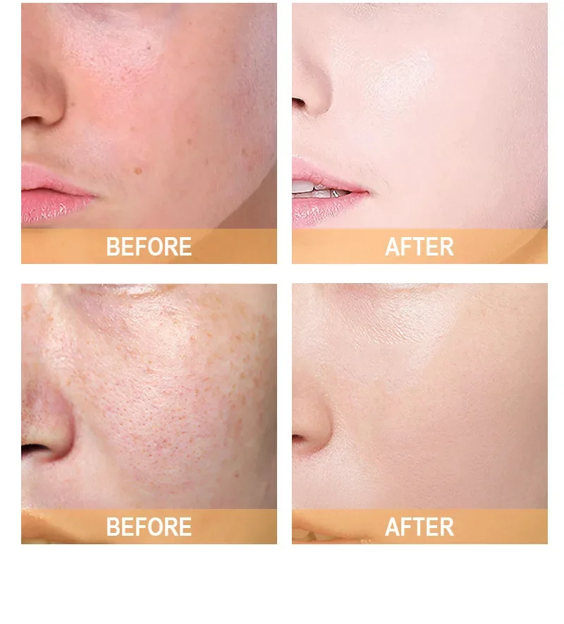 Larutan Toner Asam Glikolat 7% - Glycolic Acid Exfoliant ulasan dan harga